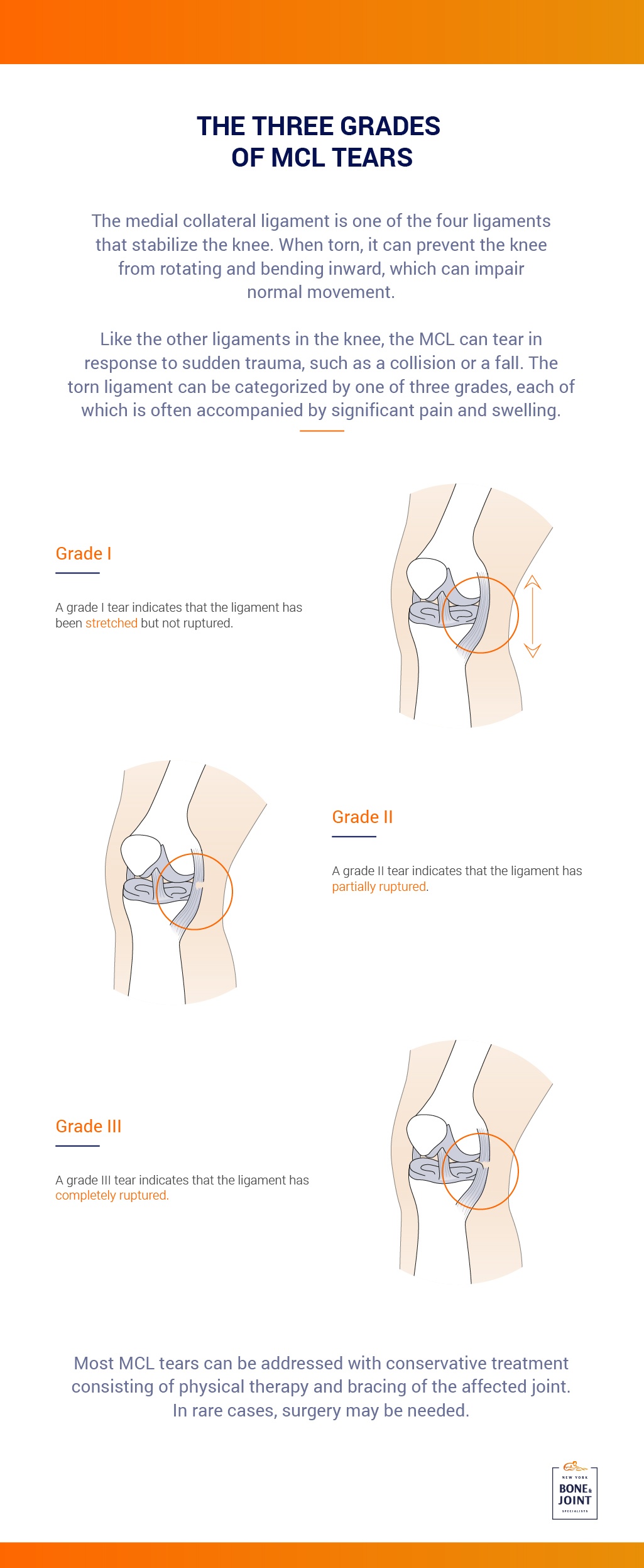 Medial Collateral Ligament (MCL) Tear Midtown East NY
