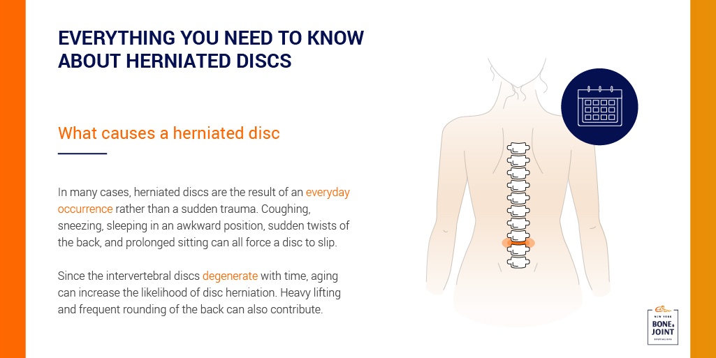 What is a Herniated Disc? The Science Behind Herniated Disc