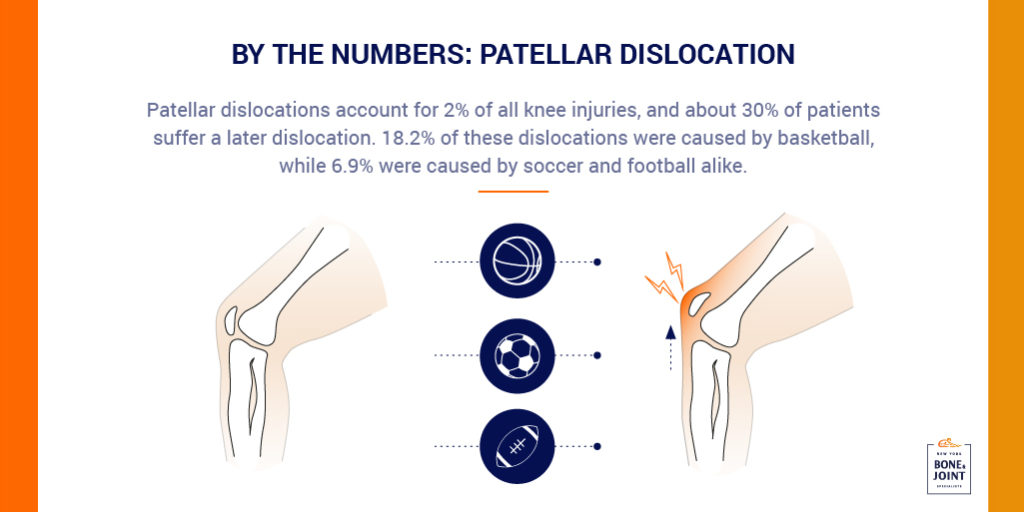 Are You At A High Risk Of Suffering A Patellar Dislocation New York