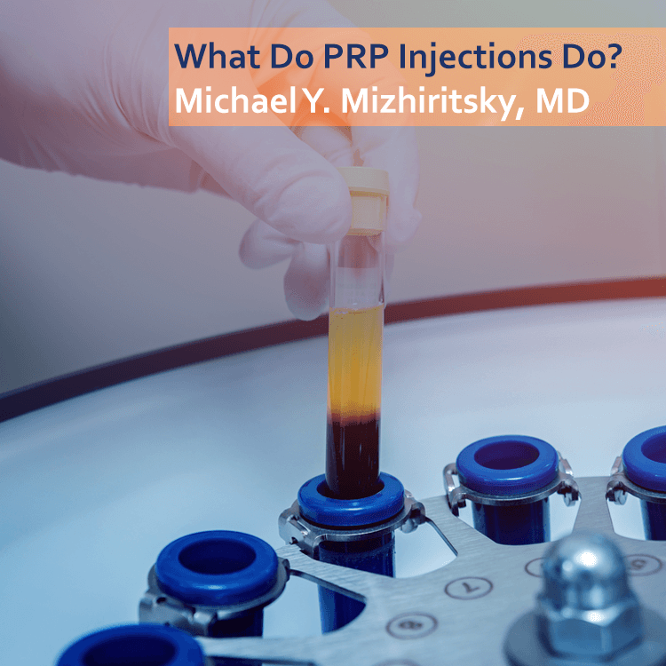 PRP Injections MM