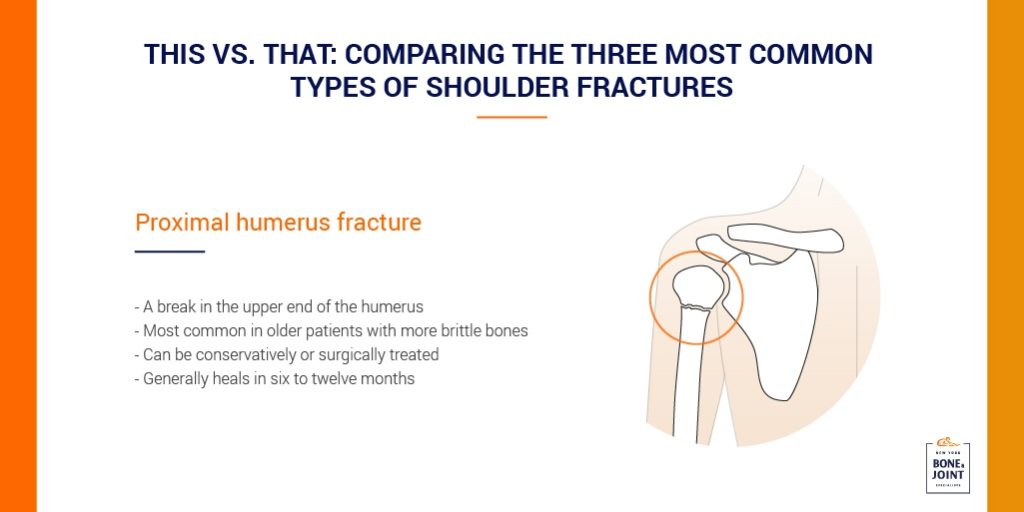 Fractured Shoulder Specialist in NYC | NY Bone & Joint