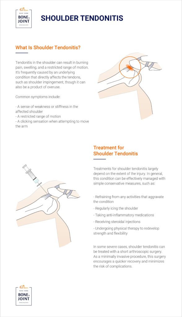 shoulder tendonitis treatment