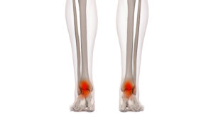 ankle-specialties.jpg