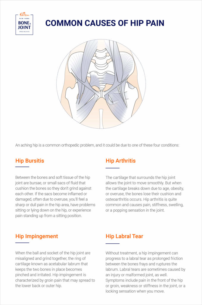 Causes of Hip Pain in Females, Columbus, OH