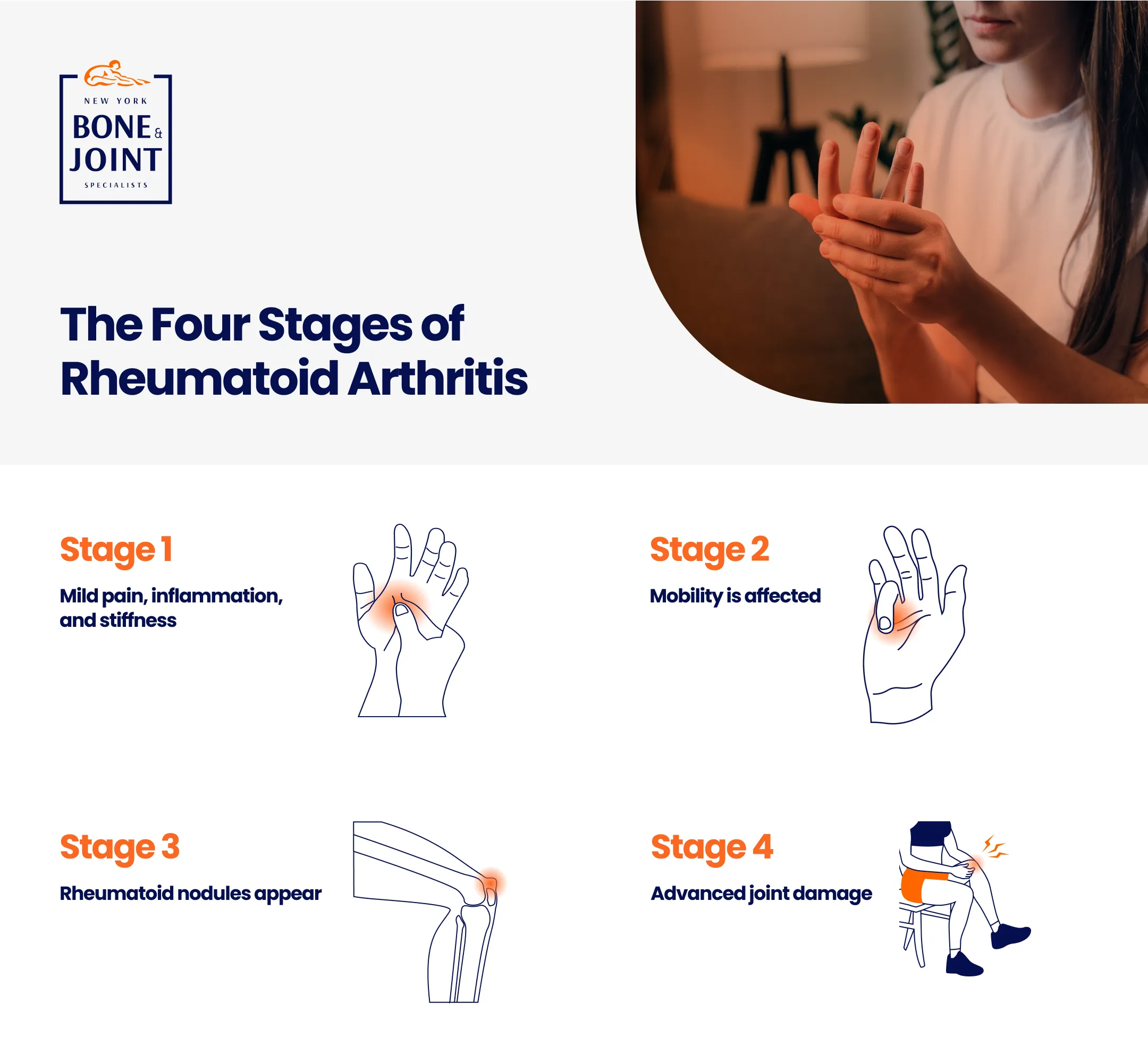 Designed infographic depicting the four stages of rheumatoid arthritis