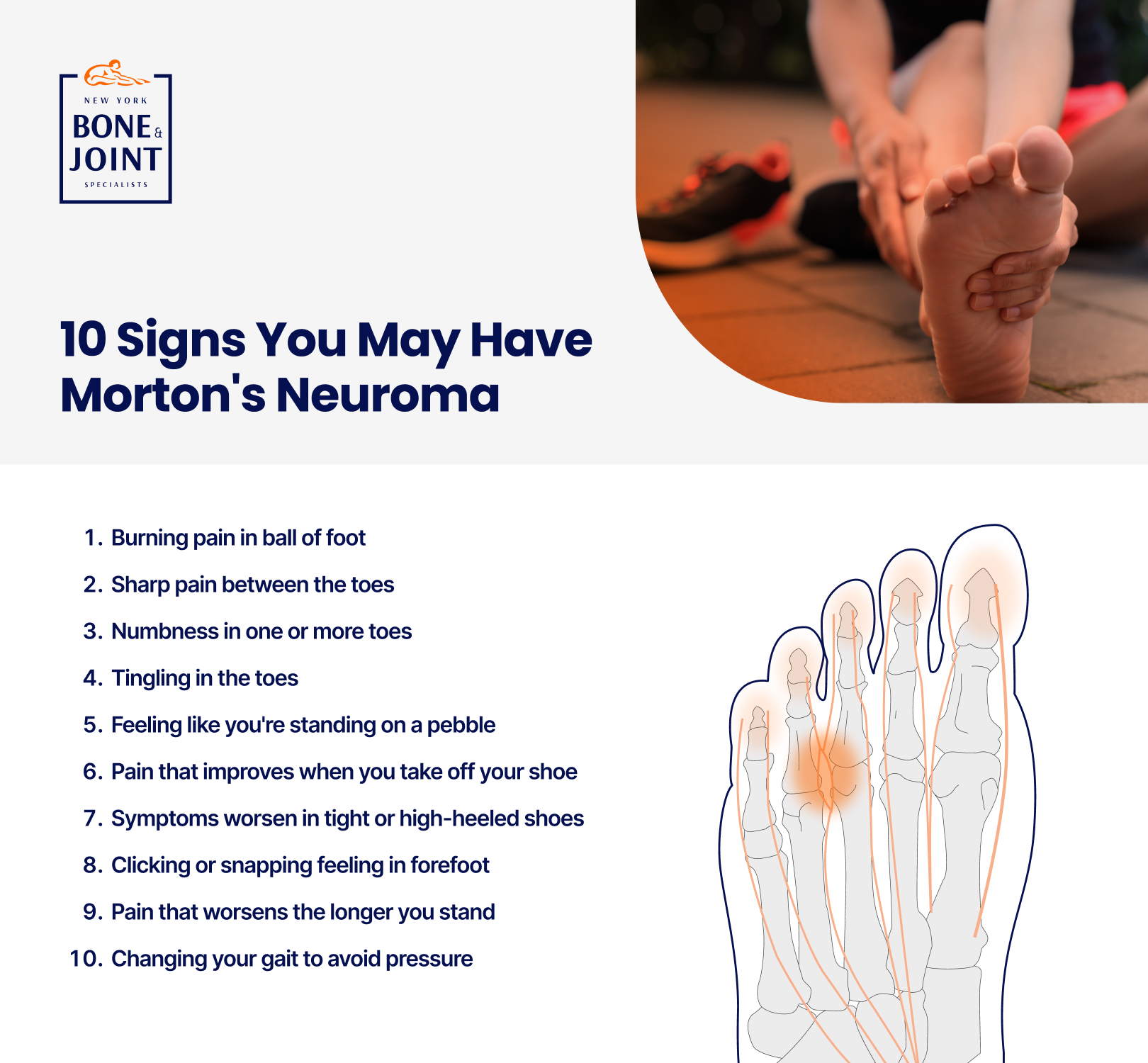 Diagram of the pain area of the foot associated with Morton's neuroma.