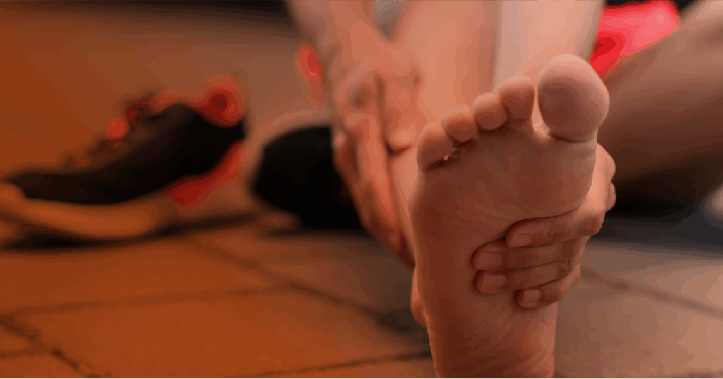 Close up image of a patient with symptoms of Morton's neuroma.