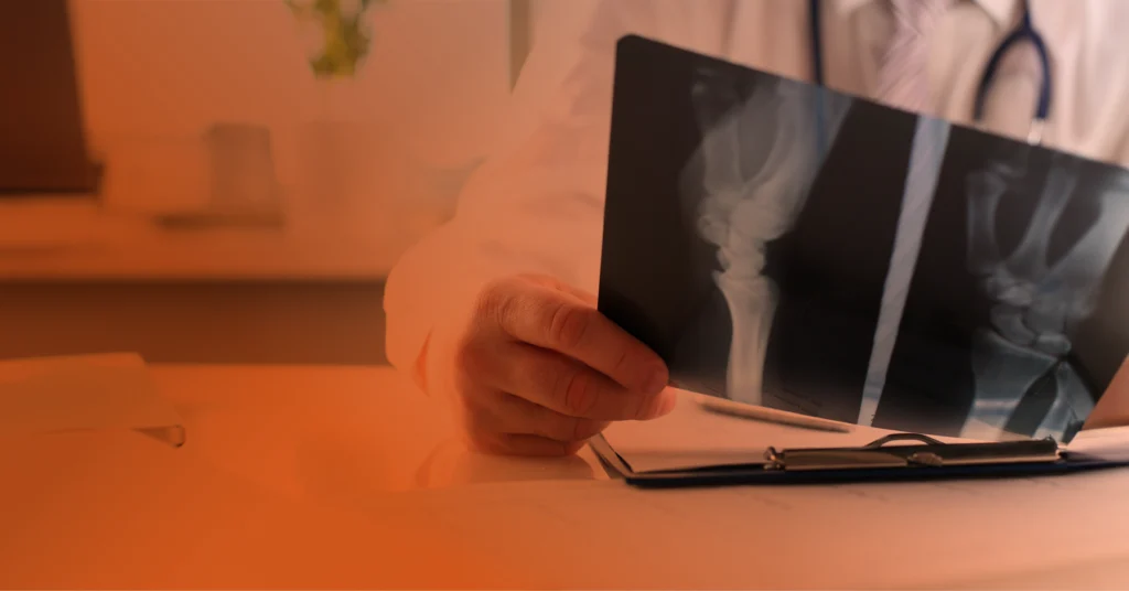 A close-up shot of an orthopedic doctor in NYC reviewing an x-ray at their desk