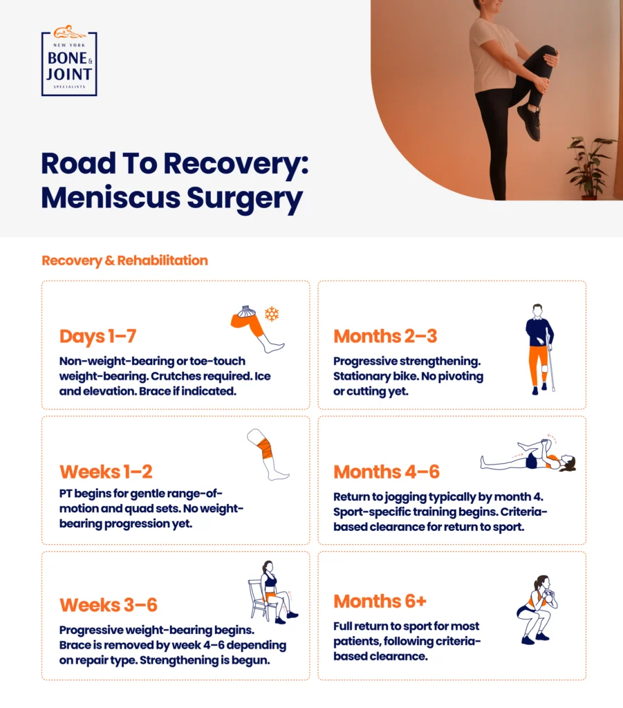 Meniscus Surgery recovery Graphic