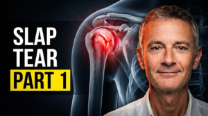 SLAP Tears and Shoulder Labral Tears: Why They’re Often Misdiagnosed